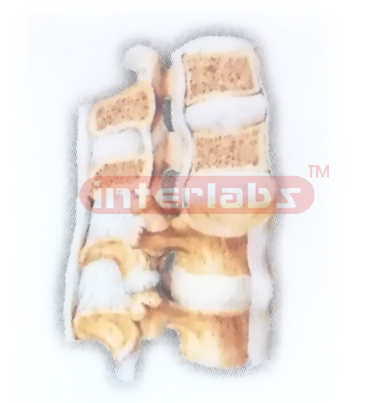 HUMAN INTERVERTEBRAL JOINTS (MEDIAN SAGITTAL SECTION) MODEL